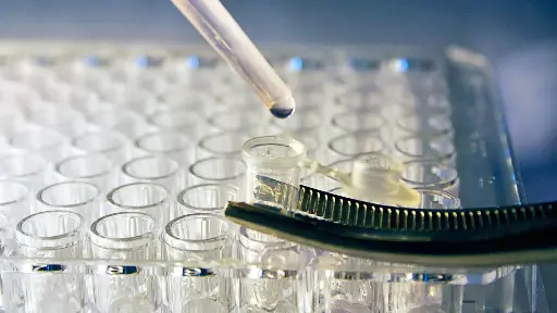 [M-GEN-EXO005] EXOGAG Plasma Isolation kit